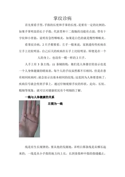 《养生》掌纹诊病