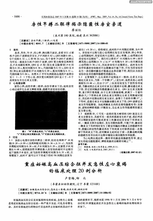 重症妊娠高血压综合征并发急性左心衰竭的临床处理20例分析