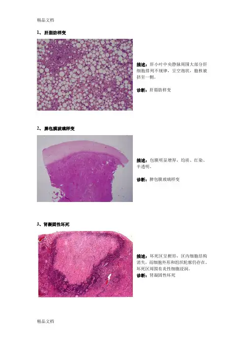 病理切片整理(汇编)