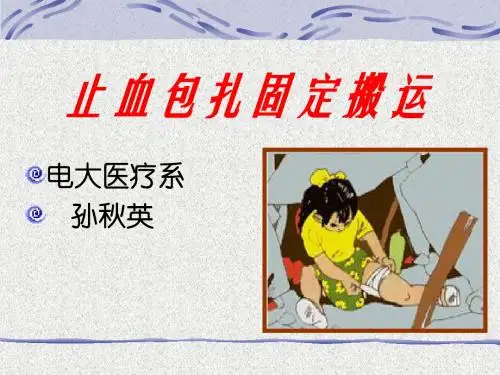 止血、包扎、固定、搬运