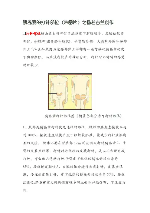胰岛素的注射部位