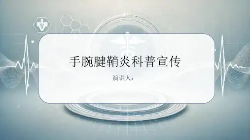 手腕腱鞘炎科普宣传