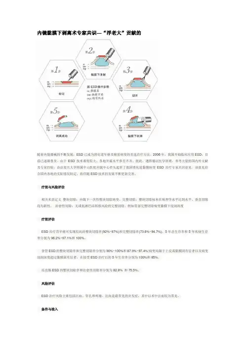 内镜黏膜下剥离术专家共识