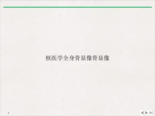 核医学全身骨显像骨显像PPT课件