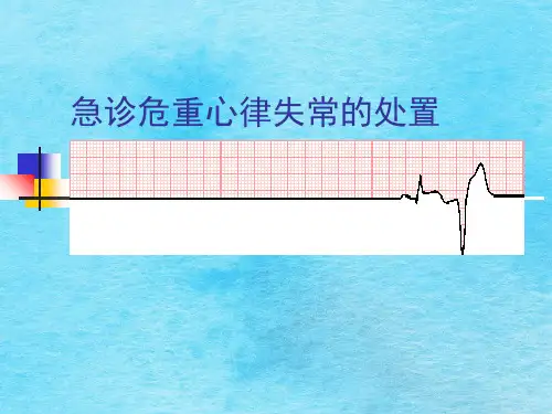 危急诊重症心律失常ppt课件