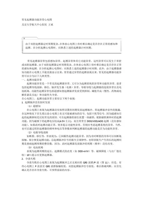 常见起搏器功能异常心电图