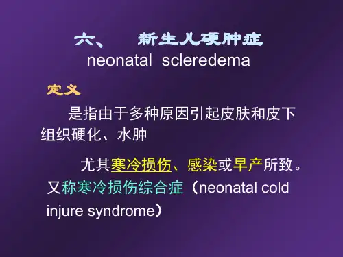 六、新生儿硬肿症ppt课件