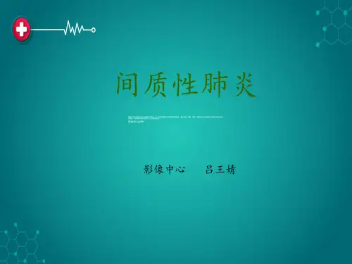 间质性肺炎ppt课件