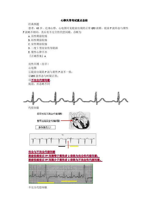 心律失常考试重点总结