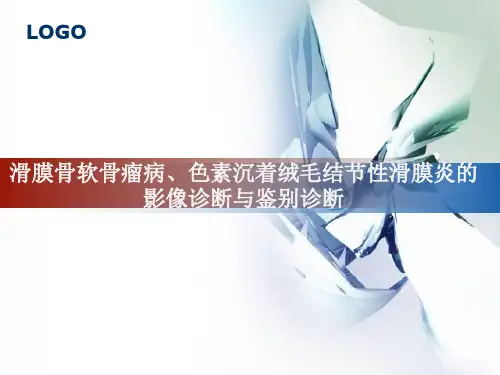 滑膜骨软骨瘤病、色素沉着绒毛结节性滑膜炎的影像诊断与鉴别诊断