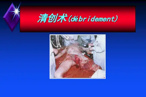 清创与换药