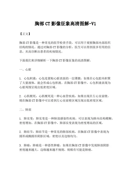 胸部CT影像征象高清图解-V1