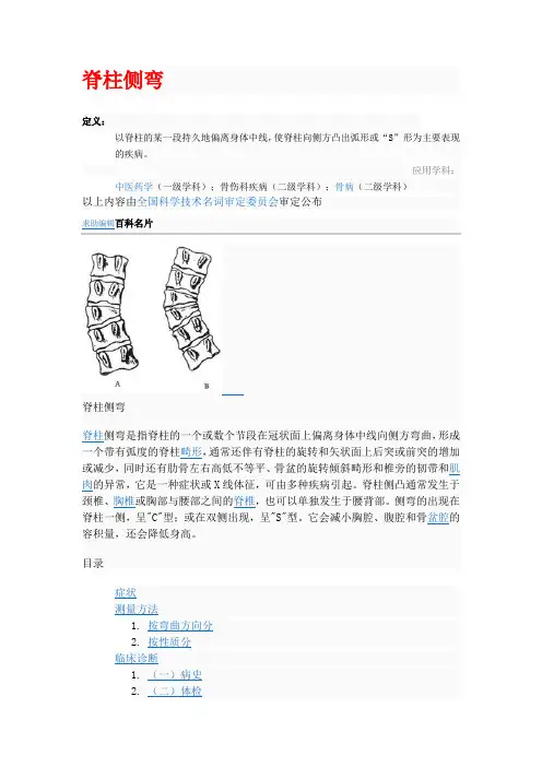 百度百科脊柱侧弯