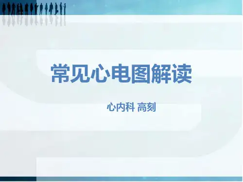 常见心电图解读PPT课件