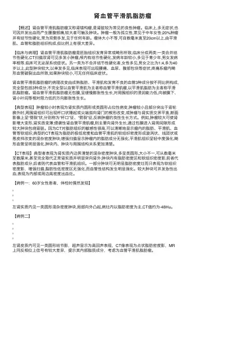 肾血管平滑肌脂肪瘤