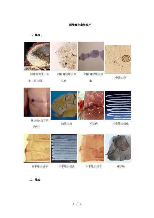 医学寄生虫学图片word版