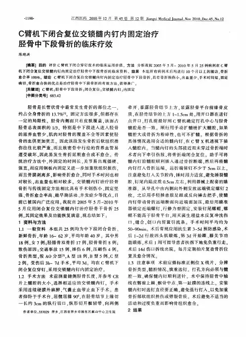 C臂机下闭合复位交锁髓内钉内固定治疗胫骨中下段骨折的临床疗效