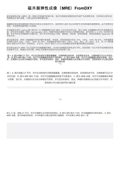 磁共振弹性成像（MRE）FromDXY