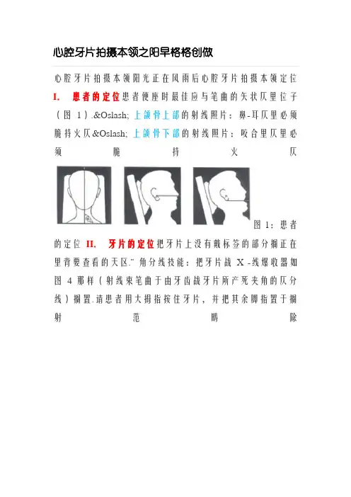 口腔牙片拍摄技巧