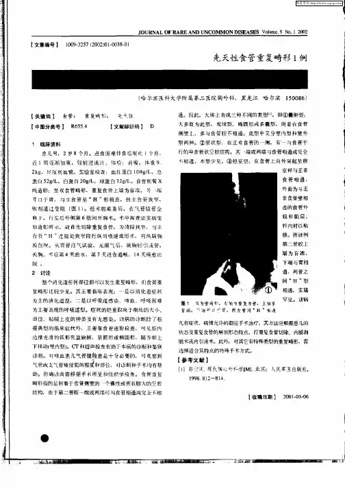 先天性食管重复畸形1例