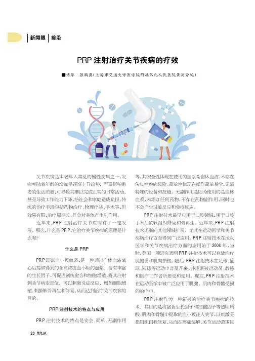 PRP注射治疗关节疾病的疗效
