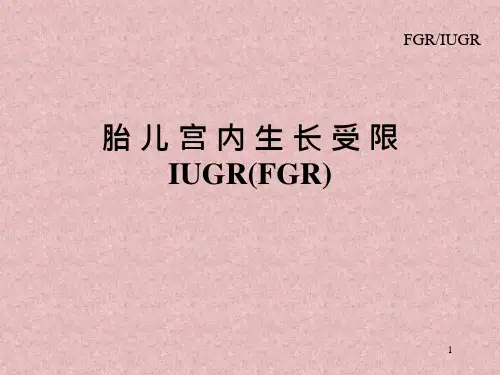 IUGR(FGR)胎儿宫内生长受限——妇产科学精品课件