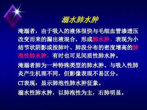 特殊类型肺炎PPT参考幻灯片