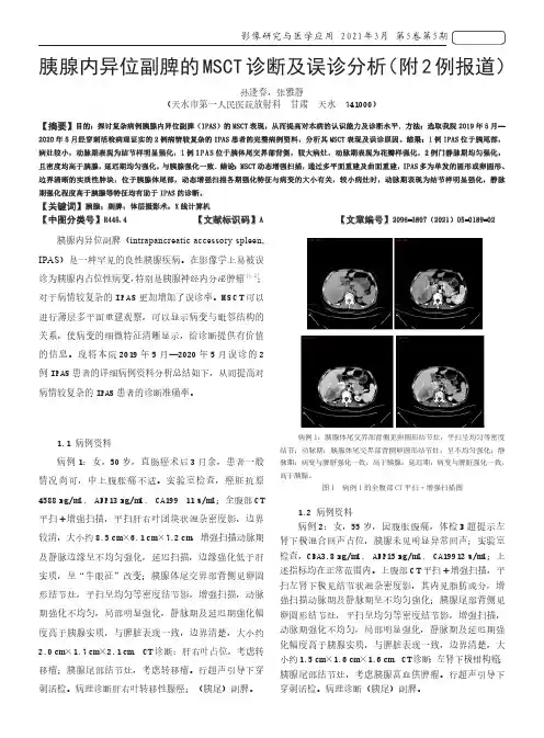 胰腺内异位副脾的MSCT诊断及误诊分析(附2例报道)