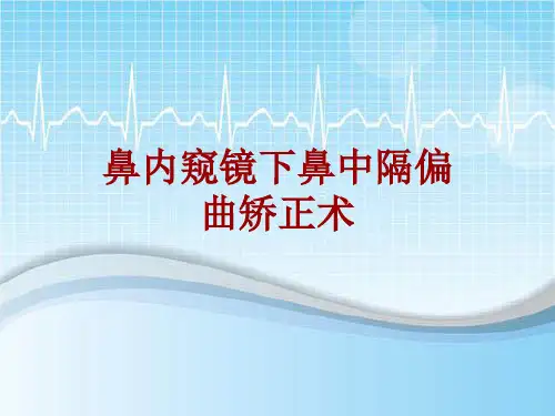 手术讲解模板：鼻内窥镜下鼻中隔偏曲矫正术