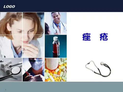痤疮PPT课件