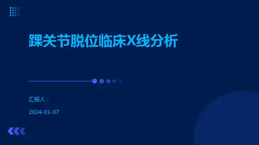 踝关节脱位临床X线分析