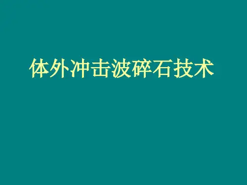 体外冲击波碎石技术宣传材料