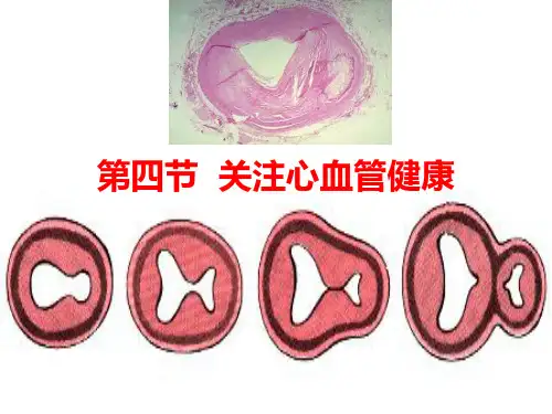 济南版七年级下册生物 3.4关注心血管健康 课件 (共16张PPT)