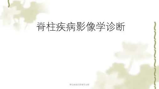 脊柱疾病的影像学诊断ppt课件