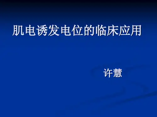 肌电诱发电位临床应用