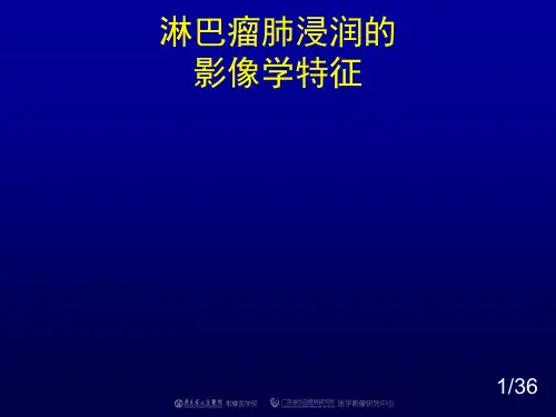 肺淋巴瘤影像表现
