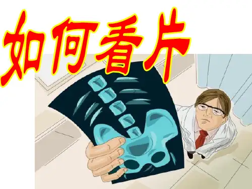 如何看颈腰椎X光片(课堂PPT)