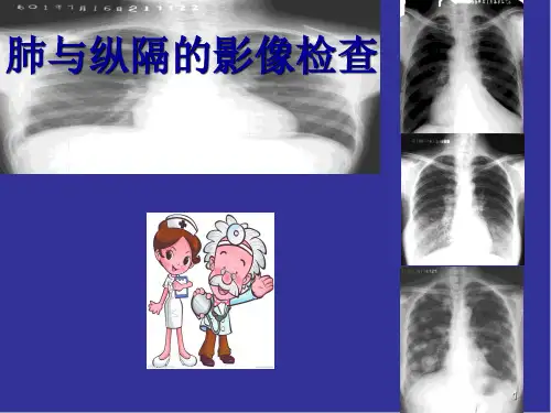(培训课件)教你如何看肺部CTPPT幻灯片