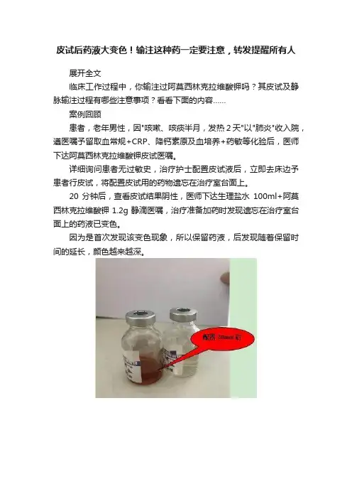 皮试后药液大变色！输注这种药一定要注意，转发提醒所有人