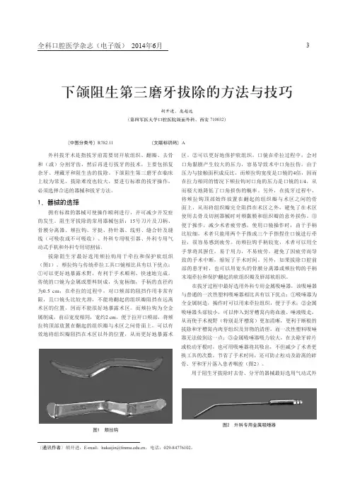 下颌阻生第三磨牙拔除的方法与技巧