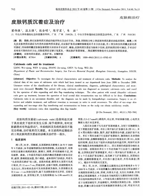 皮肤钙质沉着症及治疗[1]