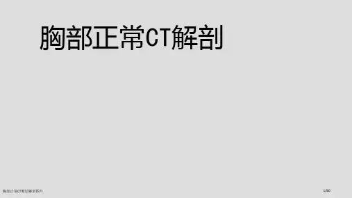 胸部正常CT断层解剖图片
