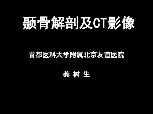 颞骨解剖与CT影像 