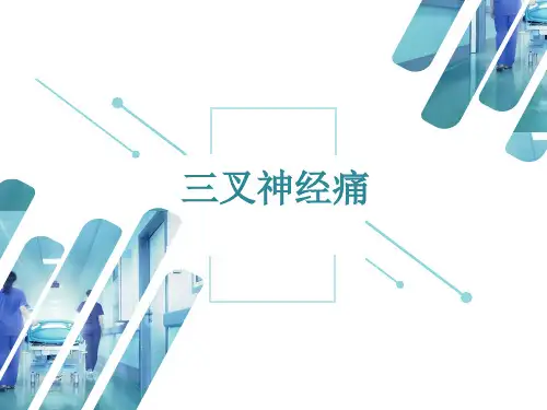 三叉神经痛