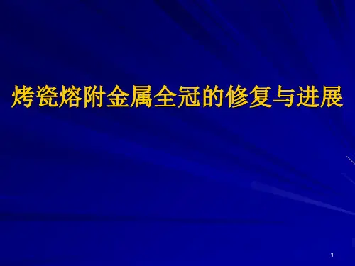 (医学课件)烤瓷熔附金属全冠修复成功的关键要素口腔