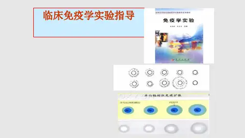 实验三单向琼脂扩散实验
