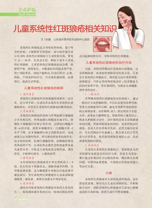 儿童系统性红斑狼疮相关知识