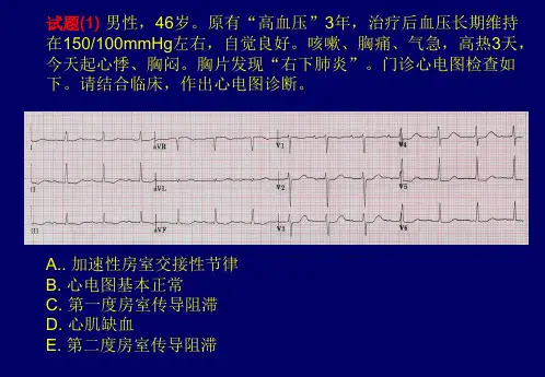 心电图试题
