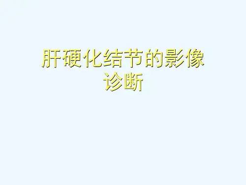 肝硬化结节的影像诊断[可修改版ppt]