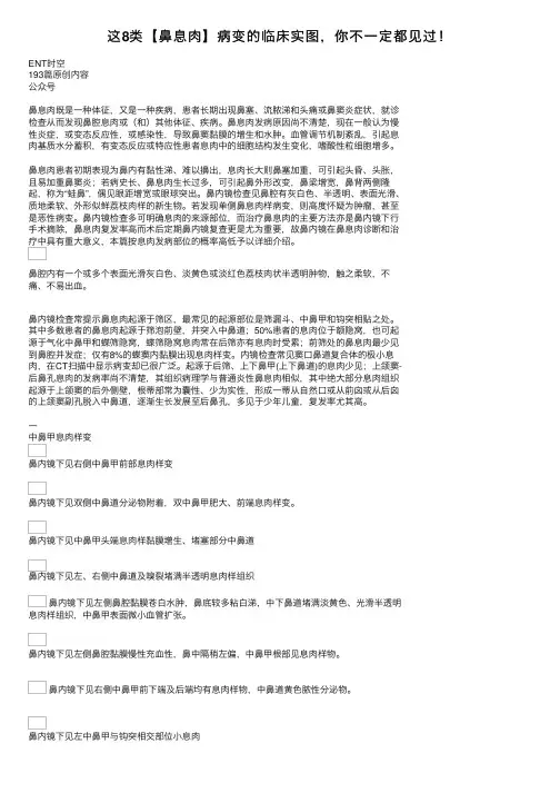 这8类【鼻息肉】病变的临床实图，你不一定都见过！